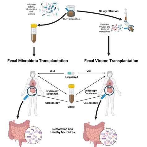 Representation Of Microbiota And Virome Transplantation In Humans The