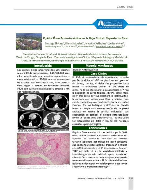 Pdf Quiste óseo Aneurismático En La Reja Costal Reporte De Caso