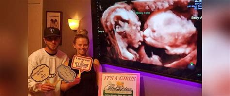 Pregnant mom's ultrasound reveals twin babies 'kissing' inside womb ...