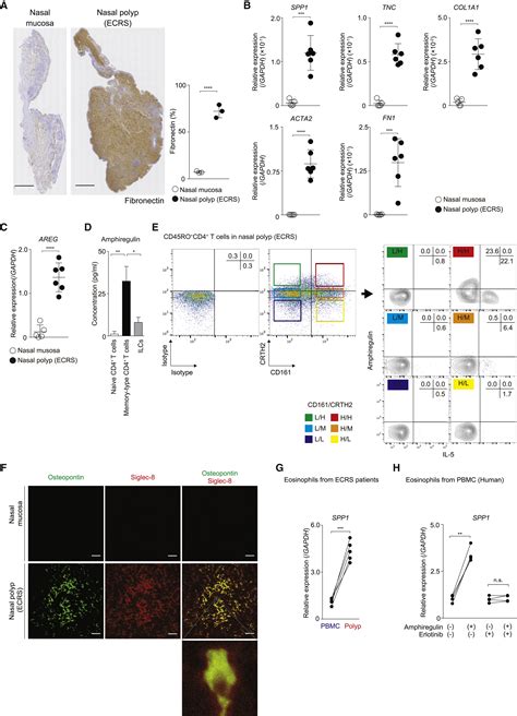 Amphiregulin Producing Pathogenic Memory T Helper 2 Cells Instruct