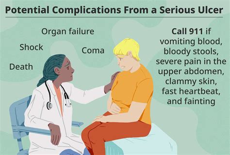 7 Symptoms of Peptic Ulcer Complications