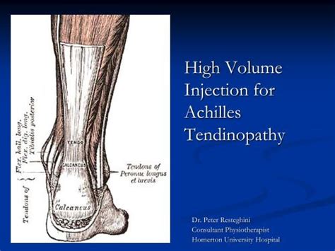 High Volume Injection For Achilles Tendinopathy Homerton