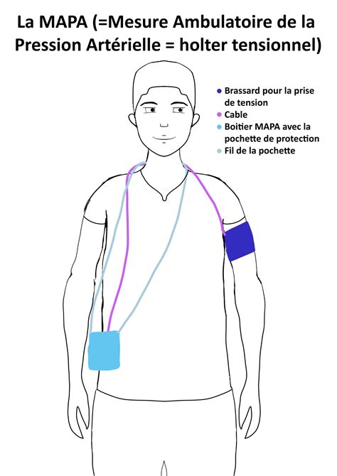 Holter Tensionnel Ou Mapa Icpc Centres De Cardiologie Paris Et