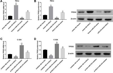 HULC Regulated TPD52 Expression By Regulating MiR 218 A B HeLa Cells