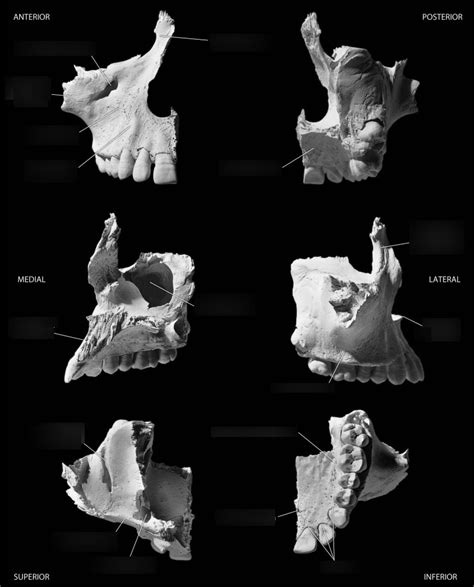 Maxillae Diagram | Quizlet