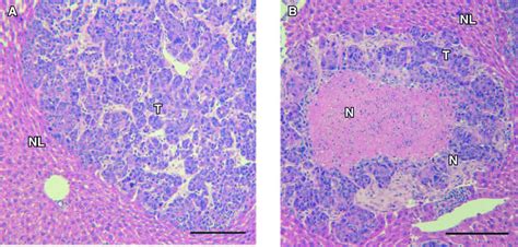 Histological Examination Of Control And SMA Pirarubicin Treated Tumors