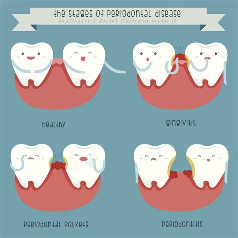 The Three Stages Of Gum Disease Kenilworth Dentist Village Dental