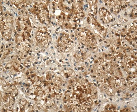 Anti Prolactin Receptor PRL R Antibody U5 Ab2772 Abcam