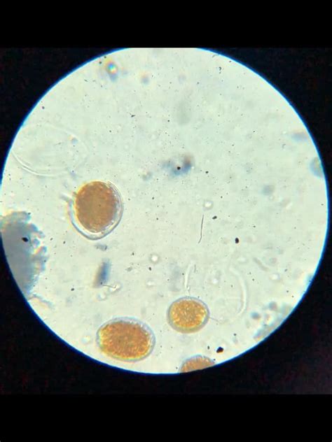 Dinoflagellates under microscope ID | Reef2Reef