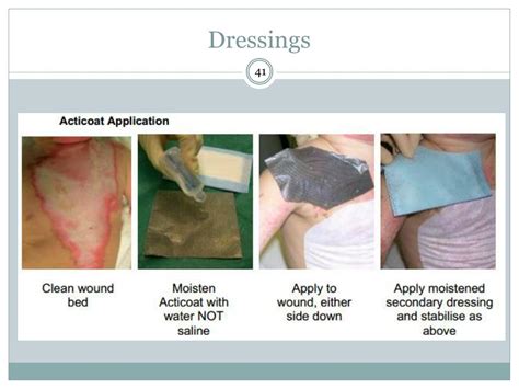 Types Of Wound Dressing Slideshare At Lucille Mcdougall Blog