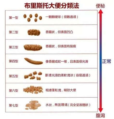 十人九痔，如何判斷是痔瘡還是腸癌？提醒：可以從這3個方面判斷 每日頭條