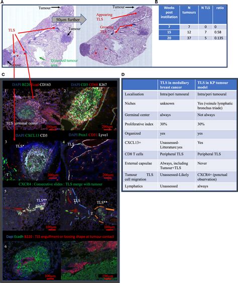 Tertiary Lymphoid Structures TLS Appear After Tumor Onset Are