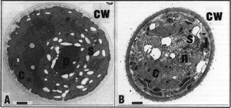 TEM view of one of the green zoospores (A) and orange-red spores (B ...