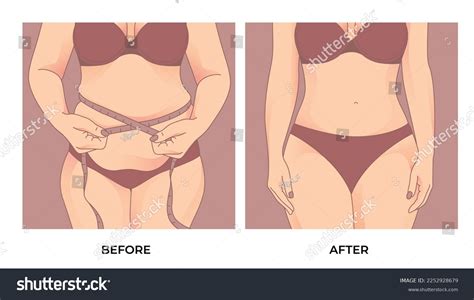 18 276 Weight Loss Excessive Images Stock Photos Vectors Shutterstock