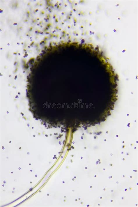 Aspergillus Niger and Aspergillus Oryzae Mold Under Microscope. Stock Photo - Image of fermented ...