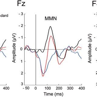 Middle Latency Responses At The F Fz And F Electrodes Mlr