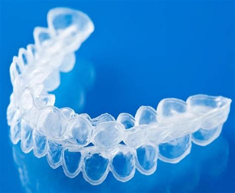 Common Mistakes When Using Invisalign Tysons Dentistry