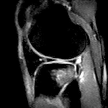 Risonanza Magnetica Articolare E MOC DEXA