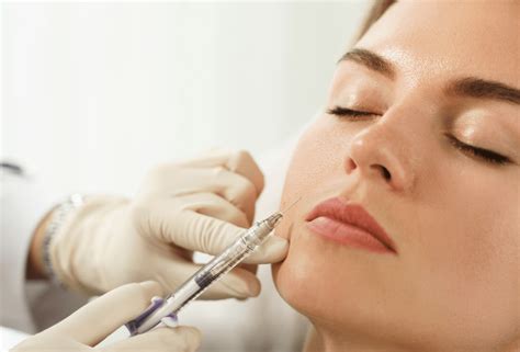 Dermal Fillers For Smile Lines Synergy Primary Care And Wellness