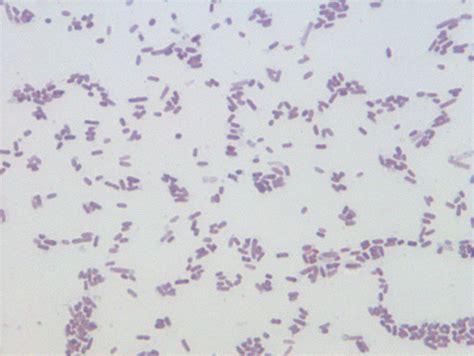 Proteus Mirabilis Gram Stain