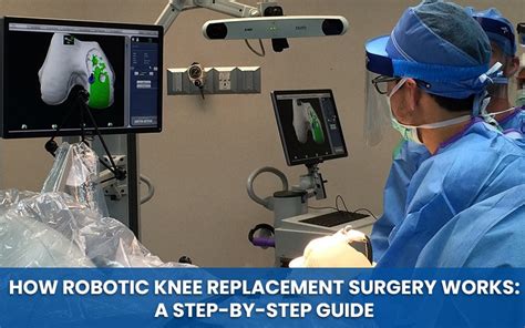 How Robotic Knee Replacement Surgery Works A Step By Step Guide Dr