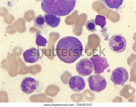 205 Metamyelocyte Images, Stock Photos, 3D objects, & Vectors ...