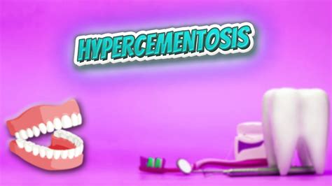 Hypercementosis - Everything Dentistry 🍎👄🔊 - YouTube