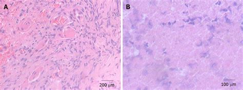 Histopathology Findings A Histopathology Shows Granulation Download Scientific Diagram