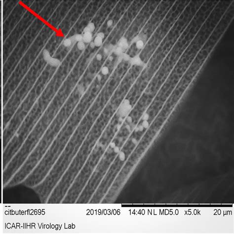 Scanning Electron Microscopy Hitachi Tabletop TM3030 Was Performed On