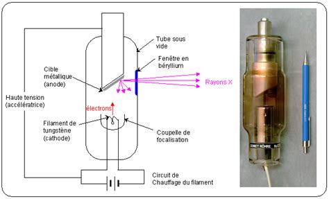 Onde Utilis Pour La Radiographie