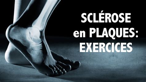 Scl Rose En Plaques Des Exercices Pour Les Pieds Et Chevilles Niv