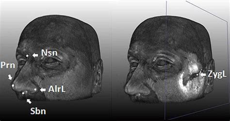 5 Face Shaping Genes Identified Dna Drawing Face Shapes Face