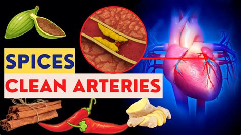 11 Powerful Spices To Clean Your Arteries That Can Prevent A Heart