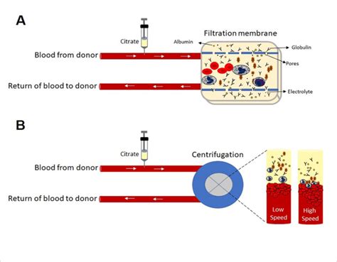 Centrifugation And Filtration Principle In Collecting Immune Plasma