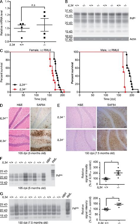 Figure 3 From A Neuroprotective Role For Microglia In Prion Diseases