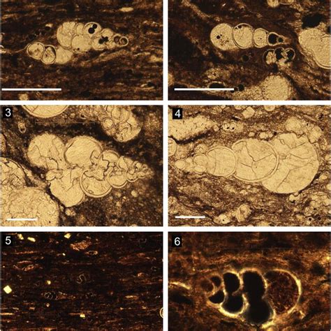 Photomicrographs Of Biserial And Triserial Planktonic Foraminifera From