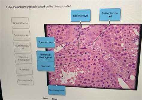 Solved Label The Photomicrograph Based On The Hints Chegg