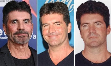 Simon Cowell Has Sparked Concern As He Continues To Look His