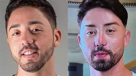 Veja O Antes E Depois Da Harmoniza O Facial De Rico Melquiades Tudoep