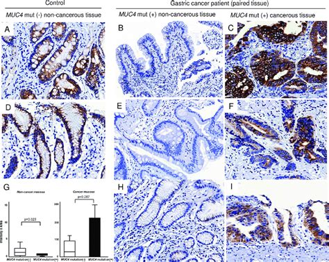 Representative Photomicrographs Of Ihc For Muc In Noncancerous And