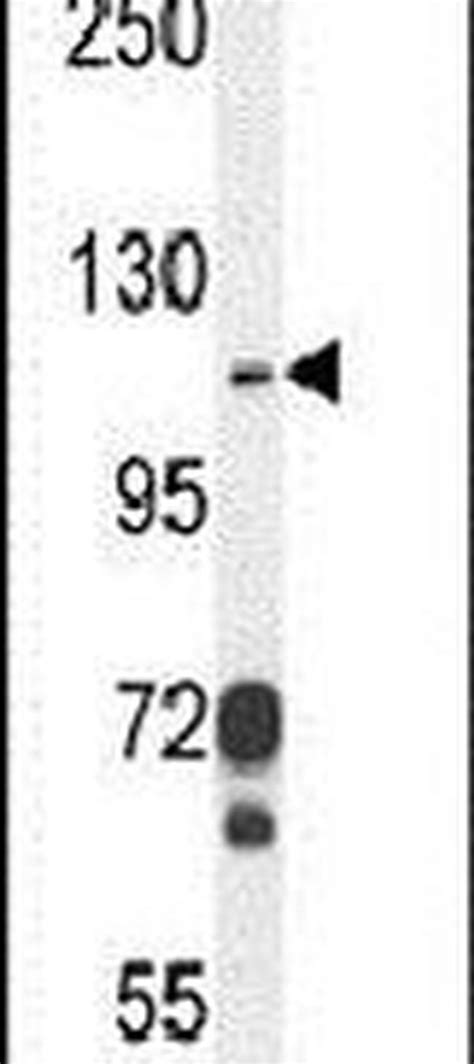 CD103 Polyclonal Antibody (PA5-23996)