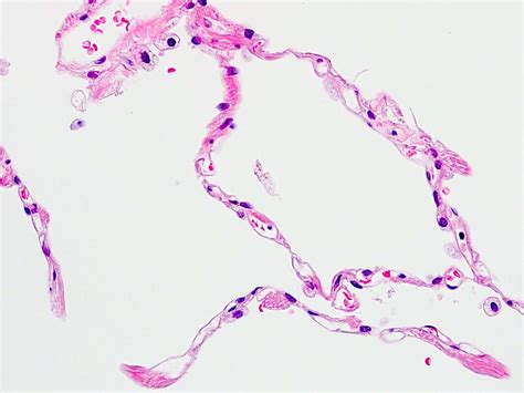 Lung Alveoli Histology