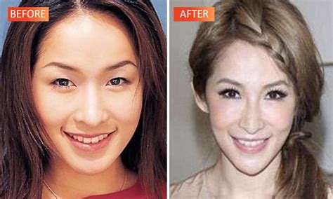 Did Taiwan’s Elva Hsiao have plastic surgery? Check out her drastic ...