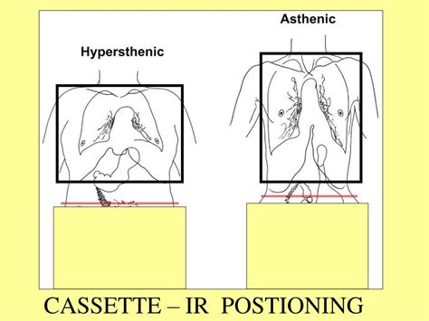 PPT Basic Radiographic Procedures CHEST LAB PowerPoint Presentation