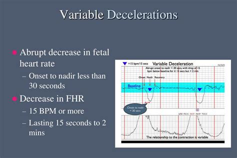 Ppt Fetal Heart Rate Monitoring Powerpoint Presentation Free Download Id 2646802