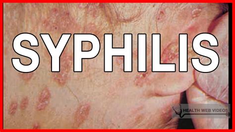 Syphilis Rash Stages