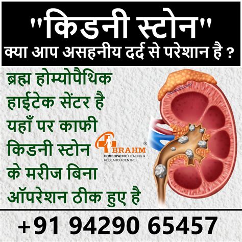 Kidney stone treatment. KIDNEY STONE TREATMENT WITHOUT SURGERY… | by ...