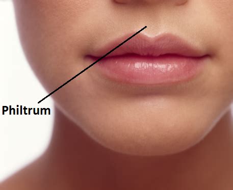 The Philtrum | News | Dentagama