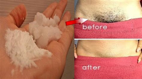 How To Remove Pubic Hair Permanently Naturally In 5 Minutes Youtube