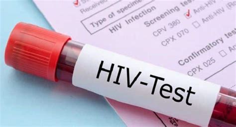 HIV diagnosis: Tests for HIV infection | TheHealthSite.com